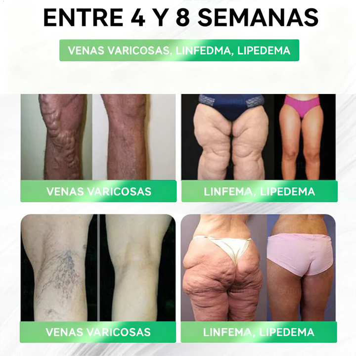 𝑪𝒍𝒆𝒂𝒏𝒔𝒊𝒏𝒈® 𝑮𝑳𝑷-1 8 𝒆𝒏 1 𝑭𝒊𝒕 & 𝑽𝒊𝒕𝒂𝒍 (𝒔𝒐𝒍𝒐 𝒖𝒏𝒂 𝒗𝒆𝒛 𝒂𝒍 𝒅𝒊́𝒂, 𝒄𝒂𝒎𝒃𝒊𝒐𝒔 𝒗𝒊𝒔𝒊𝒃𝒍𝒆𝒔 𝒆𝒏 7 𝒅𝒊́𝒂𝒔) √ 𝑷𝒂𝒓𝒂 𝒐𝒃𝒆𝒔𝒊𝒅𝒂𝒅, 𝒔𝒂𝒍𝒖𝒅 𝒄𝒂𝒓𝒅𝒊𝒐𝒗𝒂𝒔𝒄𝒖𝒍𝒂𝒓, 𝒅𝒊𝒂𝒃𝒆𝒕𝒆𝒔, 𝒂𝒑𝒏𝒆𝒂 𝒅𝒆𝒍 𝒔𝒖𝒆𝒏̃𝒐, 𝒔𝒂𝒍𝒖𝒅 𝒊𝒏𝒕𝒆𝒔𝒕𝒊𝒏𝒂𝒍, 𝒑𝒓𝒐𝒃𝒍𝒆𝒎𝒂𝒔 𝒂𝒓𝒕𝒊𝒄𝒖𝒍𝒂𝒓𝒆𝒔 𝒚 𝒎𝒂́𝒔 𝒎𝒛𝒘