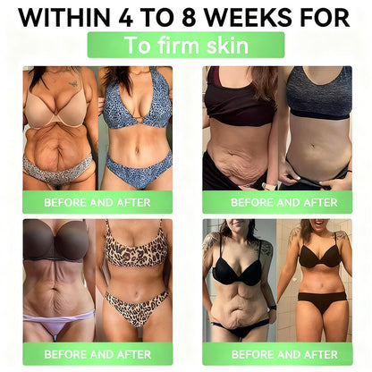 Cleansing® GLP-1 20 en 1 Suplemento Adelgazante (Resultados Visibles en 7 Días) ayuda a mejorar la obesidad, la salud cardiovascular, la diabetes, la salud intestinal, los problemas articulares, una piel más firme y un aumento de energía.