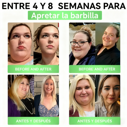 Cleansing® GLP-1 20 en 1 Suplemento Adelgazante (Resultados Visibles en 7 Días) ayuda a mejorar la obesidad, la salud cardiovascular, la diabetes, la salud intestinal, los problemas articulares, una piel más firme y un aumento de energía.