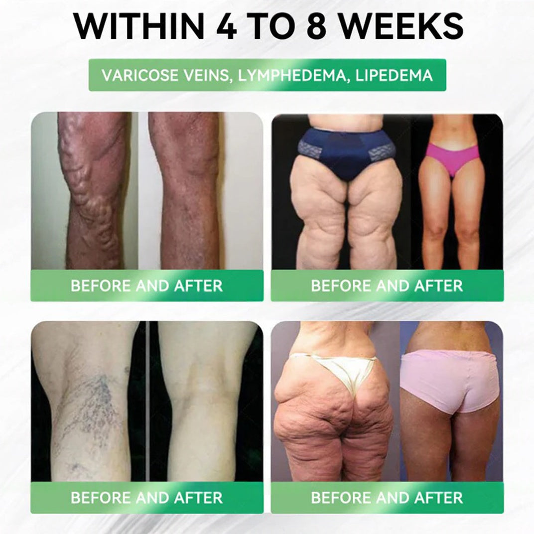 Cleansing® GLP-1 20 en 1 Suplemento Adelgazante (Resultados Visibles en 7 Días) ayuda a mejorar la obesidad, la salud cardiovascular, la diabetes, la salud intestinal, los problemas articulares, una piel más firme y un aumento de energía.